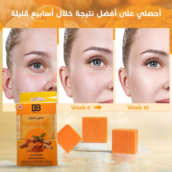 ⁦عرض حبتين صابون الكركم⁩ - الصورة ⁦3⁩